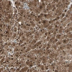 Anti-EVC Antibody