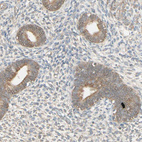 Anti-MRVI1 Antibody
