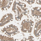 Immunohistochemical staining of human small intestine shows moderate perinuclear and cytoplasmic positivity in glandular cells.