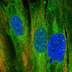 Immunofluorescent staining of human cell line BJ shows localization to nuclear bodies & cytosol.