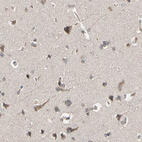 Immunohistochemical staining of human cerebral cortex shows weak to moderate cytoplasmic positivity in neurons.