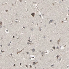 Immunohistochemical staining of human cerebral cortex shows weak to moderate cytoplasmic positivity in neurons.