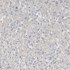 Immunohistochemical staining of human liver shows no positivity in hepatocytes as expected.