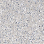 Immunohistochemical staining of human liver shows no positivity in hepatocytes as expected.