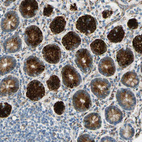 Immunohistochemical staining of human small intestine shows strong granular cytoplasmic granular in glandular cells.