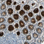 Immunohistochemical staining of human small intestine shows strong granular cytoplasmic granular in glandular cells.