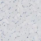 Immunohistochemical staining of human skeletal muscle shows no positivity in myocytes.