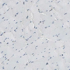 Immunohistochemical staining of human skeletal muscle shows no positivity in myocytes.