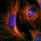 Immunofluorescent staining of human cell line U-251 MG shows localization to cytosol.