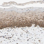 Immunohistochemical staining of human cervix, uterine shows moderate cytoplasmic positivity in squamous epithelial cells.