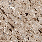 Immunohistochemical staining of human cerebral cortex shows strong cytoplasmic positivity in neurons.