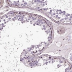 Immunohistochemical staining of human testis shows weak membranous/cytoplasmic positivity in cells in seminiferous ducts.