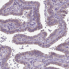 Immunohistochemical staining of human Fallopian tube shows moderate membranous/cytoplasmic positivity in glandular cells.