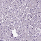 Immunohistochemical staining of human liver shows no positivity in hepatocytes, as expected.