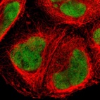 Immunofluorescent staining of human cell line A-431 shows localization to nucleus & nucleoli fibrillar center.