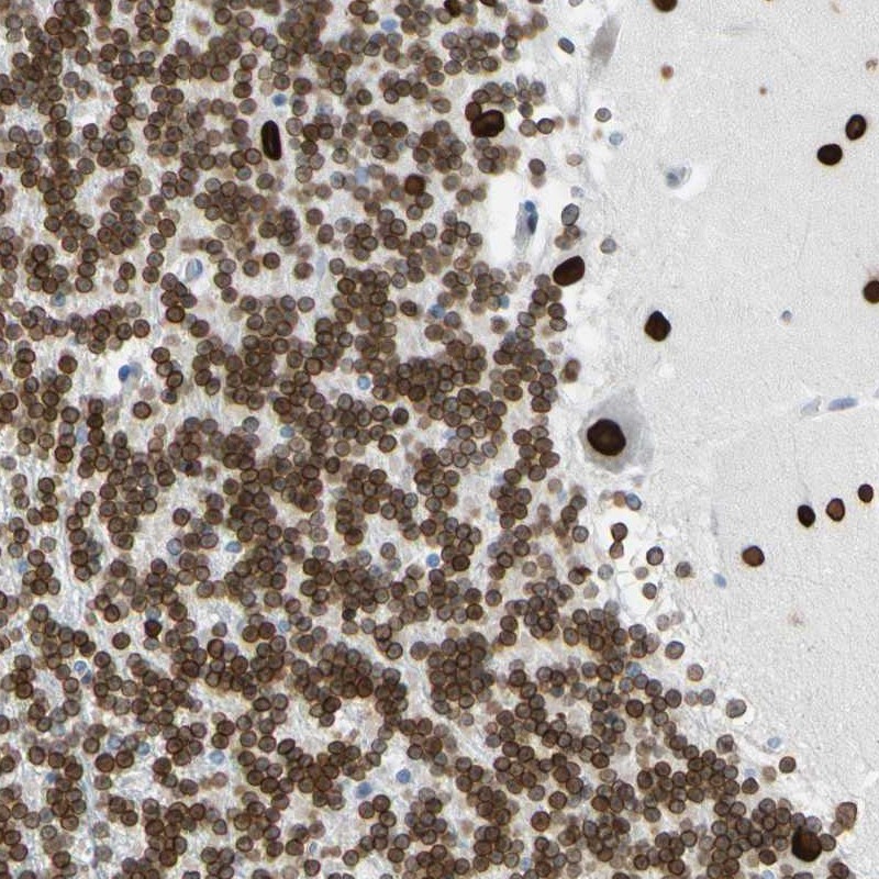 Anti-ZNF132 Antibody