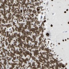 Anti-ZNF132 Antibody