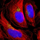 Immunofluorescent staining of human cell line U-2 OS shows localization to the Golgi apparatus.
