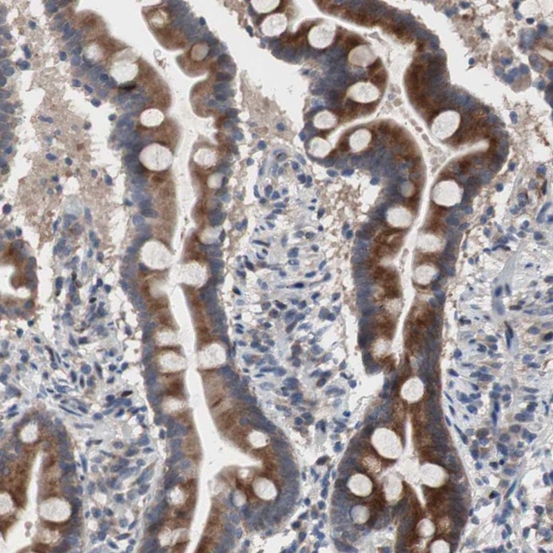 Anti-MUTYH Antibody