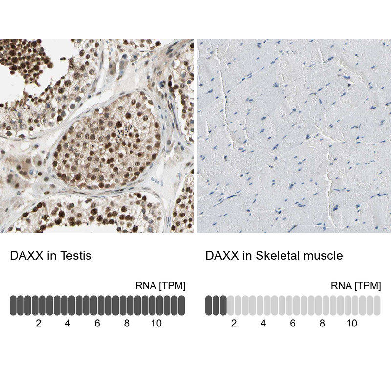 Anti-DAXX Antibody