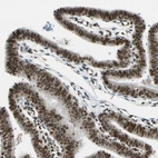 Immunohistochemical staining of human fallopian tube shows moderate to strong nuclear positivity in glandular cells.