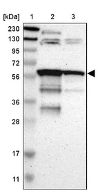 Lane 1: Marker [kDa] 230, 130, 95, 72, 56, 36, 28, 17, 11_br/_Lane 2: Human cell line RT-4_br/_Lane 3: Human cell line U-251MG sp