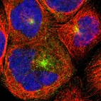 Immunofluorescent staining of human cell line A-431 shows localization to vesicles.