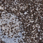 Immunohistochemical staining of human Lymph node shows strong membranous positivity in germinal and non-germinal center cells.