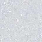 Anti-CD247 Antibody