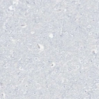 Immunohistochemical staining of human Cerebral cortex shows no positivity in neuronal cells as expected.