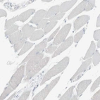Immunohistochemical staining of human Skeletal muscle shows no positivity in myocytes as expected.