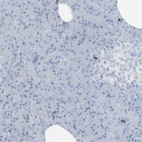 Immunohistochemical staining of human Pancreas shows no positivity in exocrine glandular cells as expected.