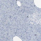Immunohistochemical staining of human Pancreas shows no positivity in exocrine glandular cells as expected.