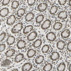 Immunohistochemical staining of human small intestine shows strong nuclear positivity in glandular cells.