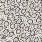 Immunohistochemical staining of human small intestine shows strong nuclear positivity in glandular cells.