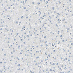 Immunohistochemical staining of human liver shows no positivity in hepatocytes as expected.