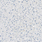 Anti-SMARCA5 Antibody