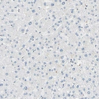 Immunohistochemical staining of human liver shows no positivity in hepatocytes as expected.