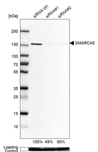 Western blot analysis in Rh30 cells transfected with control siRNA, target specific siRNA probe #1 and #2, using Anti-SMARCA5 antibody. Remaining relative intensity is presented. Loading control: Anti-GAPDH.