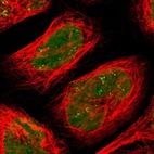 Immunofluorescent staining of human cell line A-431 shows localization to nucleus & nucleoli fibrillar center.