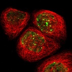 Immunofluorescent staining of human cell line A-431 shows localization to nucleoplasm & nuclear bodies.
