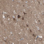 Anti-PCDHGA2 Antibody