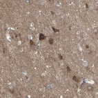 Anti-PCDHGA2 Antibody