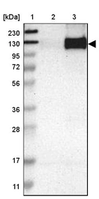 Lane 1: Marker [kDa] 230, 130, 95, 72, 56, 36, 28, 17, 11_br/_Lane 2: Human cell line RT-4_br/_Lane 3: Human cell line U-251 MG
