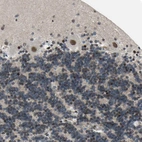 Anti-THAP12 Antibody