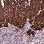 Immunohistochemical staining of human adrenal gland shows strong cytoplasmic positivity in neuroendocrine cells.