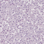 Immunohistochemical staining of human liver shows no positivity in hepatocytes as expected.