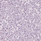 Immunohistochemical staining of human liver shows no positivity in hepatocytes as expected.