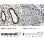 Anti-SRSF11 Antibody
