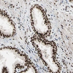 Immunohistochemical staining of human prostate shows moderate to strong nuclear positivity in glandular cells.